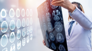 Should I Accept A Traumatic Brain Injury Settlement?
